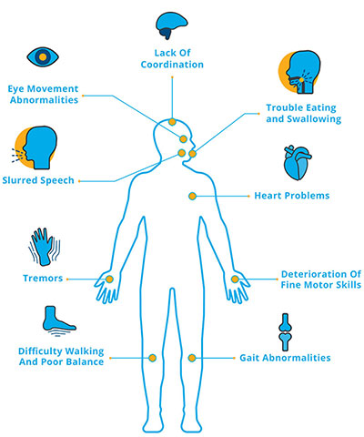 Ataxia Symptoms